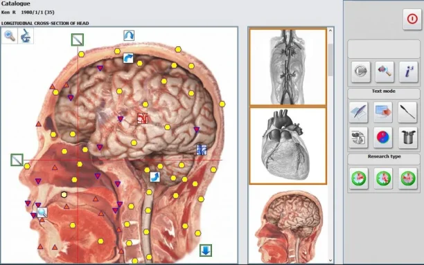 Biorresonancia1